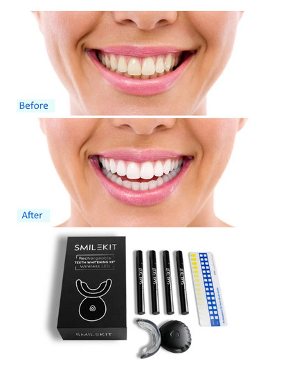 Teeth Whitening Dental Kit